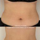 디디메디칼 이미지