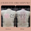 산후명인 네이버블로그