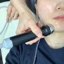조이앤유 | 마산피부관리 수앤유뷰티 티타늄레이저 후기