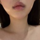 부산 남천동 에스테틱 추천｜핏톡스 디자인 관리로 이중턱·팔자라인 관리 후기