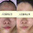 안산 상록수피부관리 도연스토리 피부샵 추천 스킨플래닝 후기