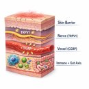 중부제일의원 | [공지] 주사피부염(rosacea) 홍조 원인 치료 — 왜 열감은 줄고 붉은기는 남는가 핵심 총정리 (치료환자...