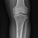 바로튼튼365의원 이미지