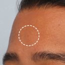 초이성형외과의원 이미지