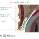 눈꺼풀 간지러움 - 비빈다고 해결될까요? 이미지