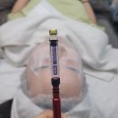 티에스(TS)메디칼 | 구서동 피부관리 트리니티뷰티 AirTS관리