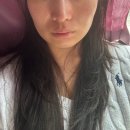 바라커피 & 플라워티 | 옆볼패임 땅콩형 얼굴 개선 미희 콜라겐 주사 강남 신논현 피부과 후기