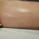 약손 | 동탄역마사지 유현옥약손스파 다리부종 후기