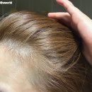 트루젠 | 탈모예방, 탈모방지 에센스 '려 트루젠' 네달 사용후기 (내돈내산 후기)