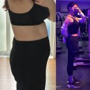 아르멍 | 복부지방흡입 붓기 멍 통증 흉터 가격 정보 총 정리