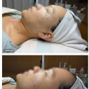 동탄 여드름관리 진짜 효과 본 곳 셀리올리 스킨랩 동탄점
