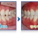 나무 기공소 이미지
