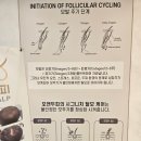 아이디어안경원(부산경성대점) | 부산 두피관리 남자탈모 모앤두피탈모 경성대점 내돈내산 3달 후기