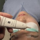 이룸메디칼 | 파주 속눈썹펌 추천 운정 속눈썹첨 잘하는곳 H뷰티리움에서 무쌍 속눈썹펌 시술 후기