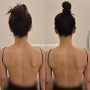 금손 | 루원시티 웨딩관리 [금손테라피] 후기