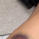 멍뽀인트 이미지