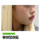 포인트성형외과의원 이미지