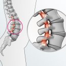 바른메드 이미지