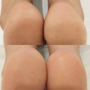 대전패디플래닝 관리 원신흥동 메이크업닻별 각질제거 후기