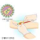 남자 여자 에이즈 초기증상 및 원인과 검사 치료제 감염경로 잠복기 붉은반점 여부 이미지