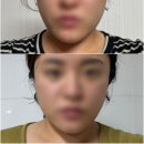 오라개발 | 팔자주름없애는법 찾는 사람이라면 주목 ‘아우라오라’ 사용후기