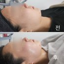 와이마트각화군왕로점 | 광주피부관리 :: 에이치앤에이치더바디 각화점, 광주 하이푸리프팅 잘하는 곳(가격,주차⭕️)