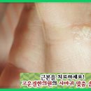 초연한의원 네이버블로그