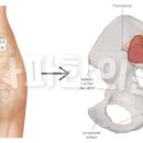 꼬리뼈 통증 위치 엉덩이뼈 꼬리뼈가 아픈이유 (임산부 포함) 알아볼까요 이미지