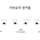 비트윈성형외과의원 이미지