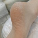 더스무스레푸스 | 울산 발각질 케어 나를 위한 관리 레푸스 울산삼산점 후기