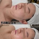 통영피부관리 마르스킨 SPA 후기