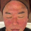 [안산피부관리] 남편의 피부가 달라졌어요! 안산피부관리 에스알뷰티센터 방문후기!