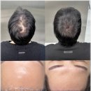 어드반SMP 이미지