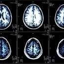 헬스케어S 이미지