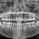 사랑니를부탁해구강악안면외과치과의원 이미지