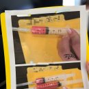 디마레의원 | <디마레성형외과 얼굴지흡 1일차 리얼후기>