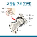 고관절 통증과 원인, 고관절 인공관절, 수술 후 4시간만의 보행, 기적을 느껴보세요. 이미지