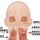 후두부 신경통 원인, , 법, 운동 방법 이미지