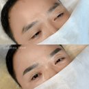 다음 | 건대 남자 눈썹문신, 시술 다음날 후기 | 구의역 아무브로우 (건대·강변·군자)
