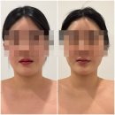 동이살롱 | 아산 탕정 피부관리 리프팅 윤곽 관리 후기 살롱드코지