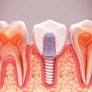 참편한치과의원 이미지