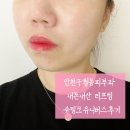 인천구월동피부과 내돈내산 리프팅 슈링크유니버스후기
