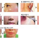 오마레피부샵