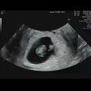 서울아가온여성의원 이미지