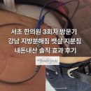 서초 한의원 3회차 방문기 강남 지방분해침 뱃살 지분침 내돈내산 솔직 효과 후기