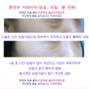 지방이식 사진-얼굴, 볼살, 눈밑 자가지방이식 전후사진 이미지