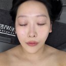 방배 | 듀베로더스킨 프리미엄 케어 후기 ✨ 방배피부관리 찾다가 발견한 진짜 맞춤 에스테틱!