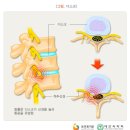 더디스크 이미지