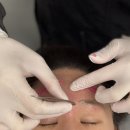 하나슈퍼 | 강남역 왁싱 슈퍼왁싱 헤어라인·이마·눈썹 후기 – 모낭염 없이 깔끔하게 변신한 리뷰 (고릴라...