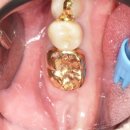 애플치과기공소 이미지